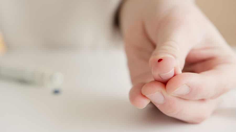 Prueba de sangre capilar para medición médica