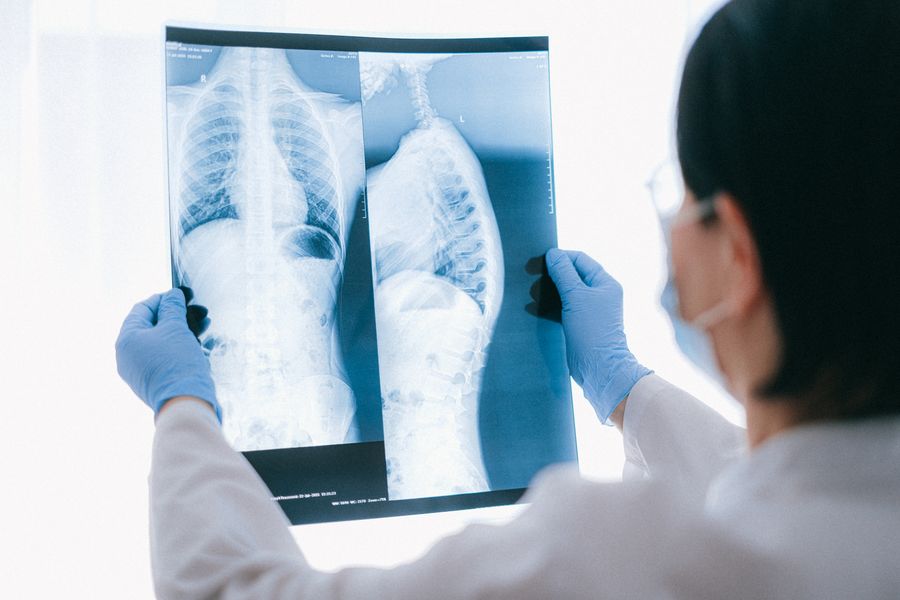 Radiografía torácica para diagnóstico médico