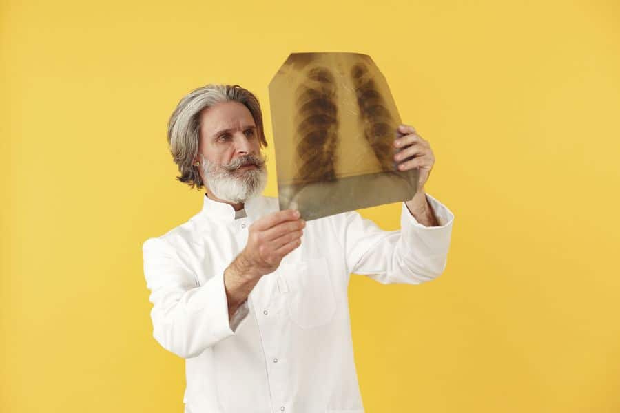 medico examinando radiografia pulmonar 1 Médico examinando radiografía pulmonar