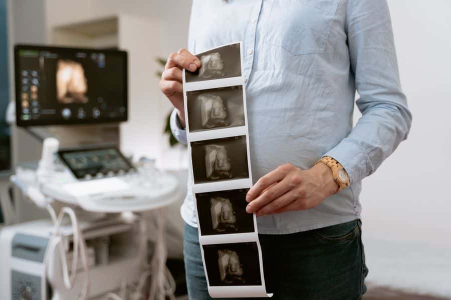 Monitoreo fetal con imágenes ecográficas