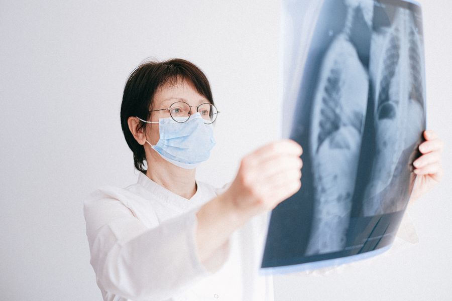 radiografia pulmonar diagnostico clinico 2 Radiografía pulmonar en diagnóstico clínico